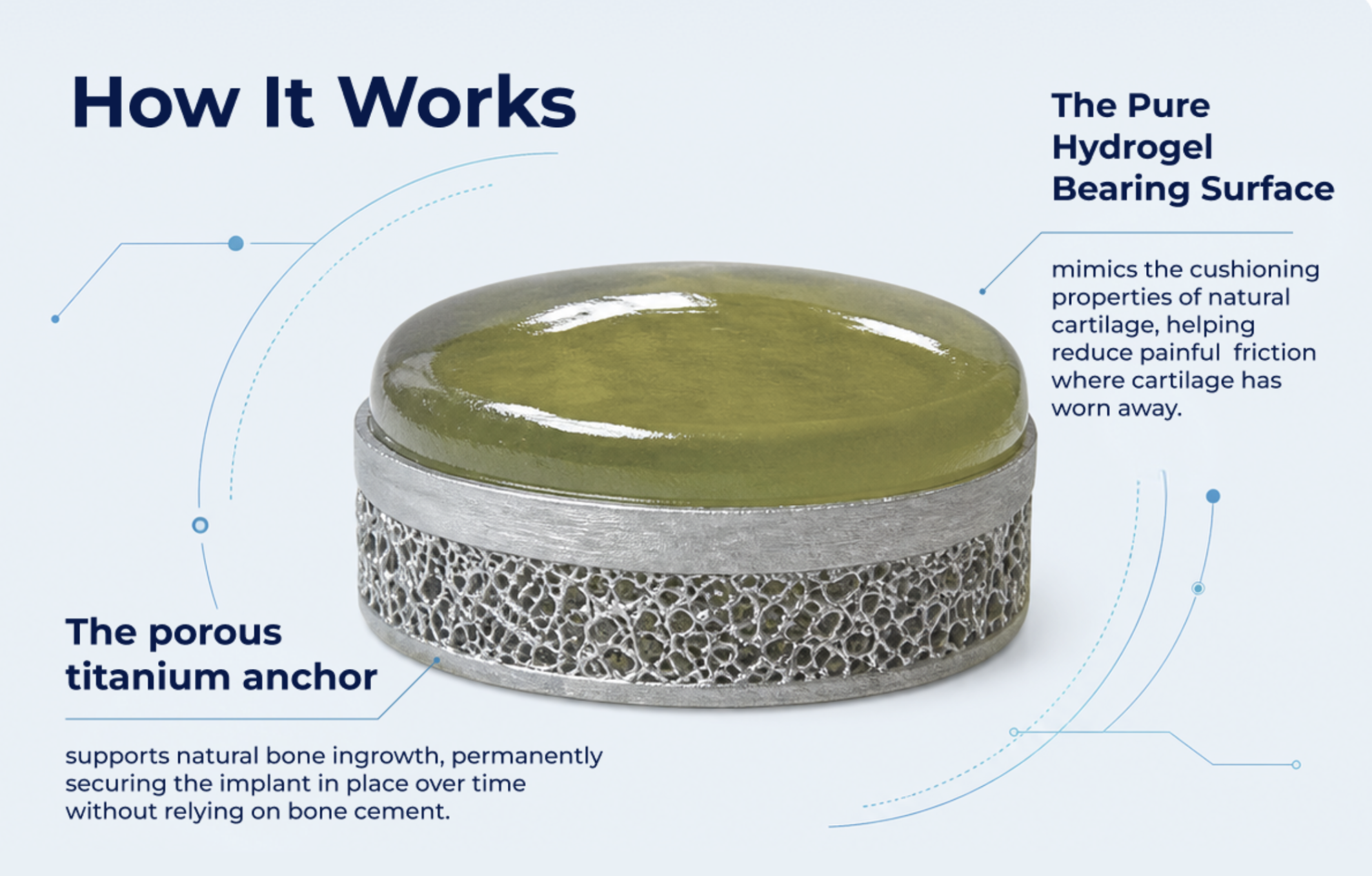 CyborGel_how it works