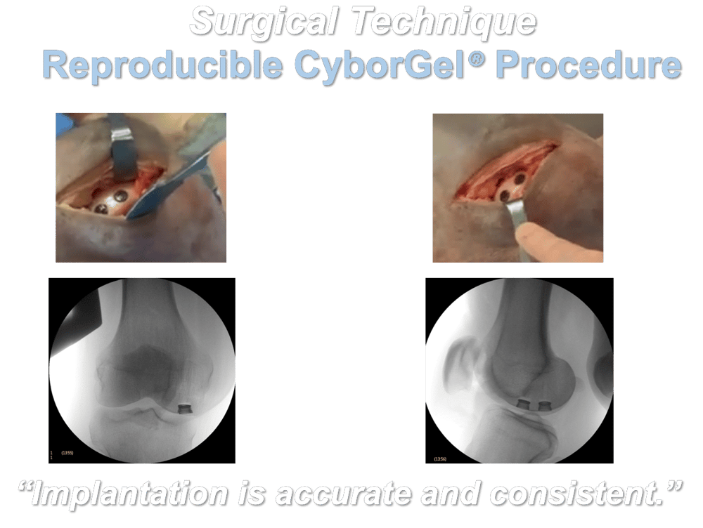 procedure