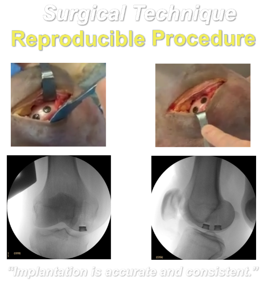 procedure_mobile2