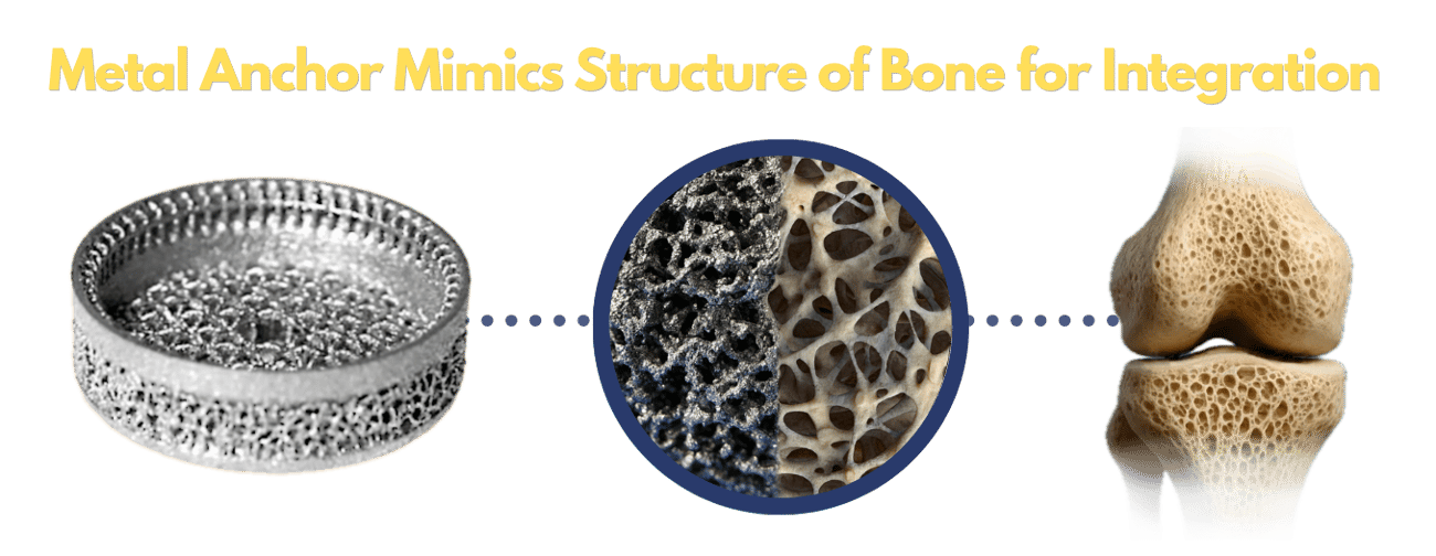 Osseointegration