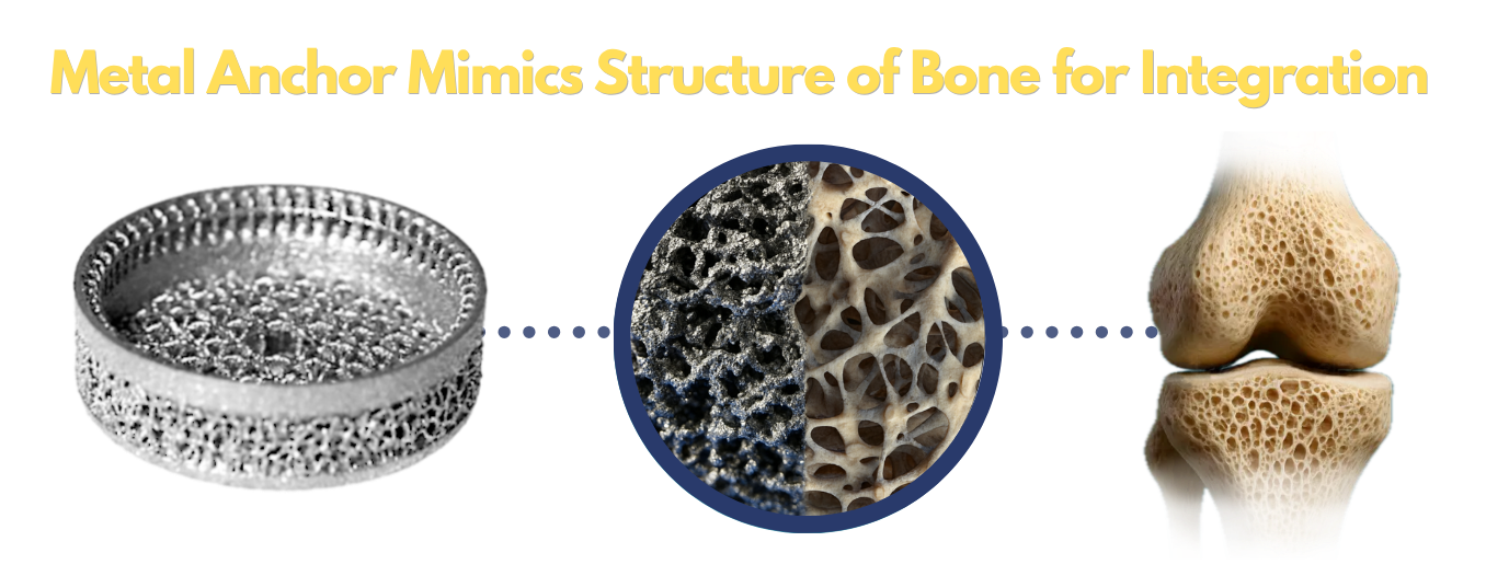 Osseointegration