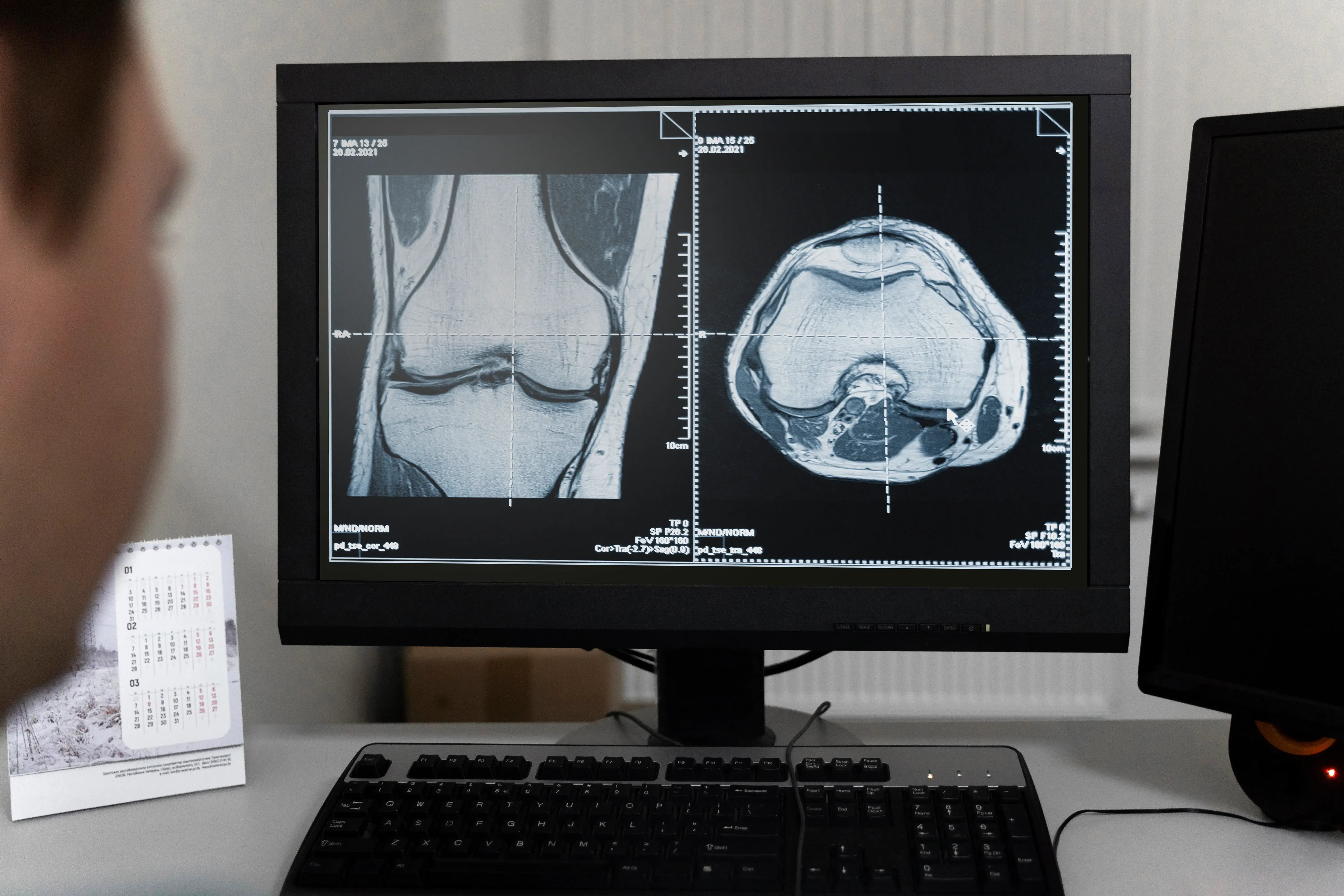 doctor-looking-ct-scans-computer
